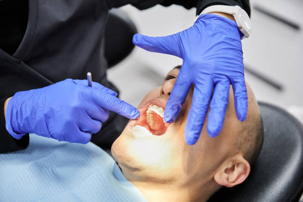 Best Emergency Dentist for Lost Fillings or Crowns in Battlement Mesa, CO